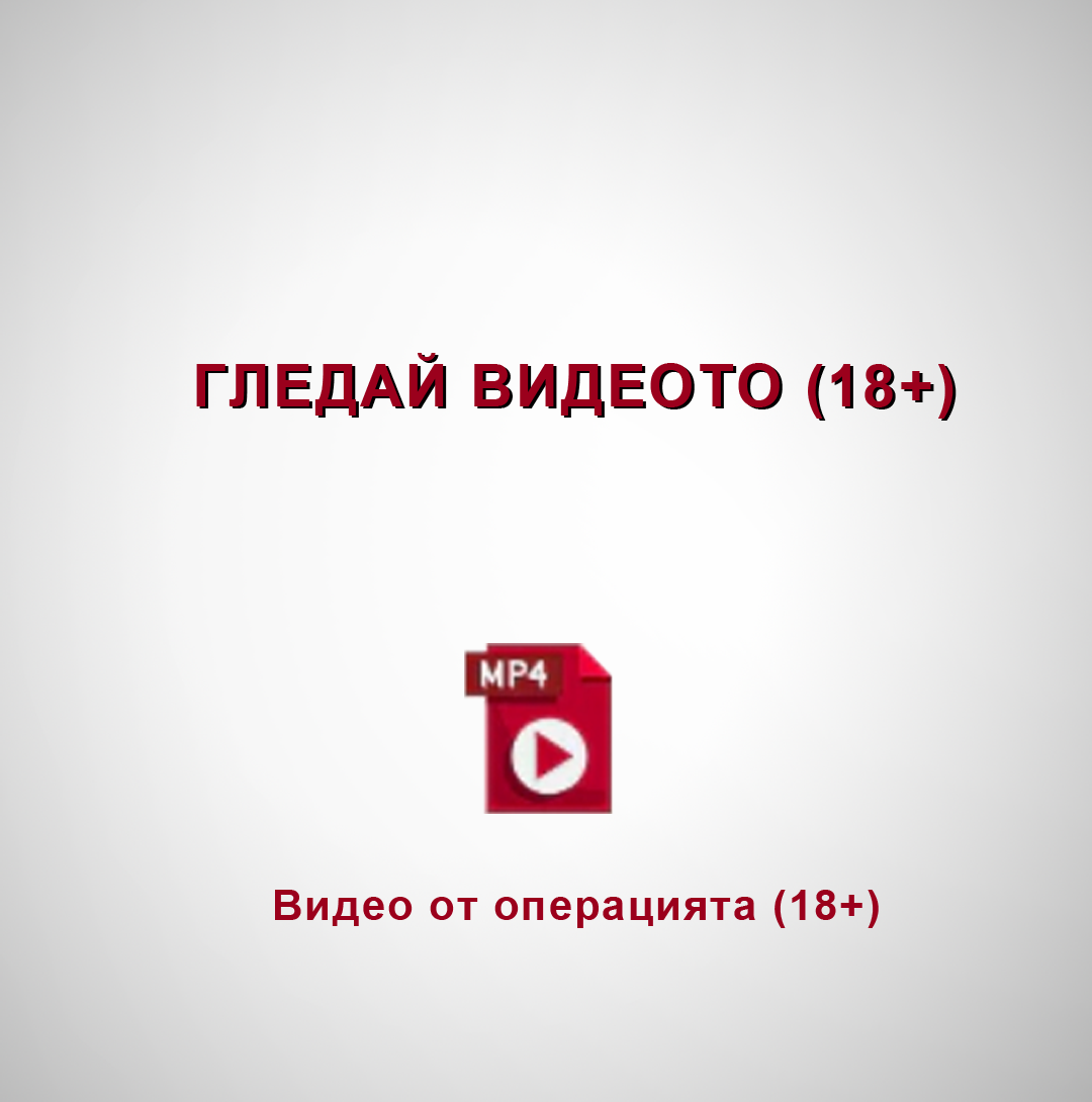 Видео от операцията